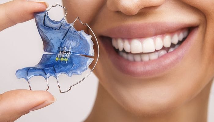 contenção ortodontica azul odontogama