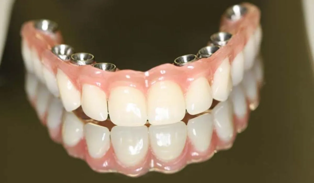 Dentadura x Prótese Protocolo: Qual a Melhor Opção?