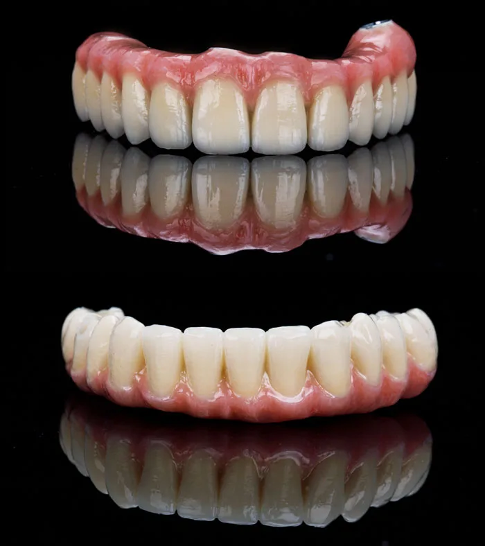 Prótese Protocolo Superior e Inferior: Diferenças no Tratamento