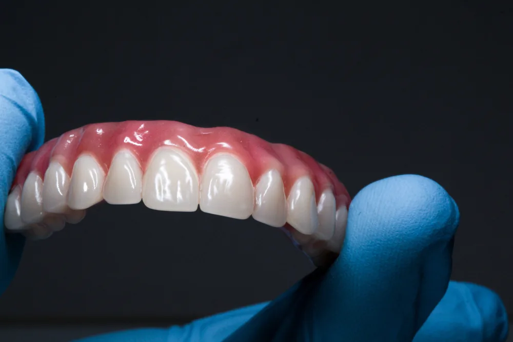 implante de carga imediata: