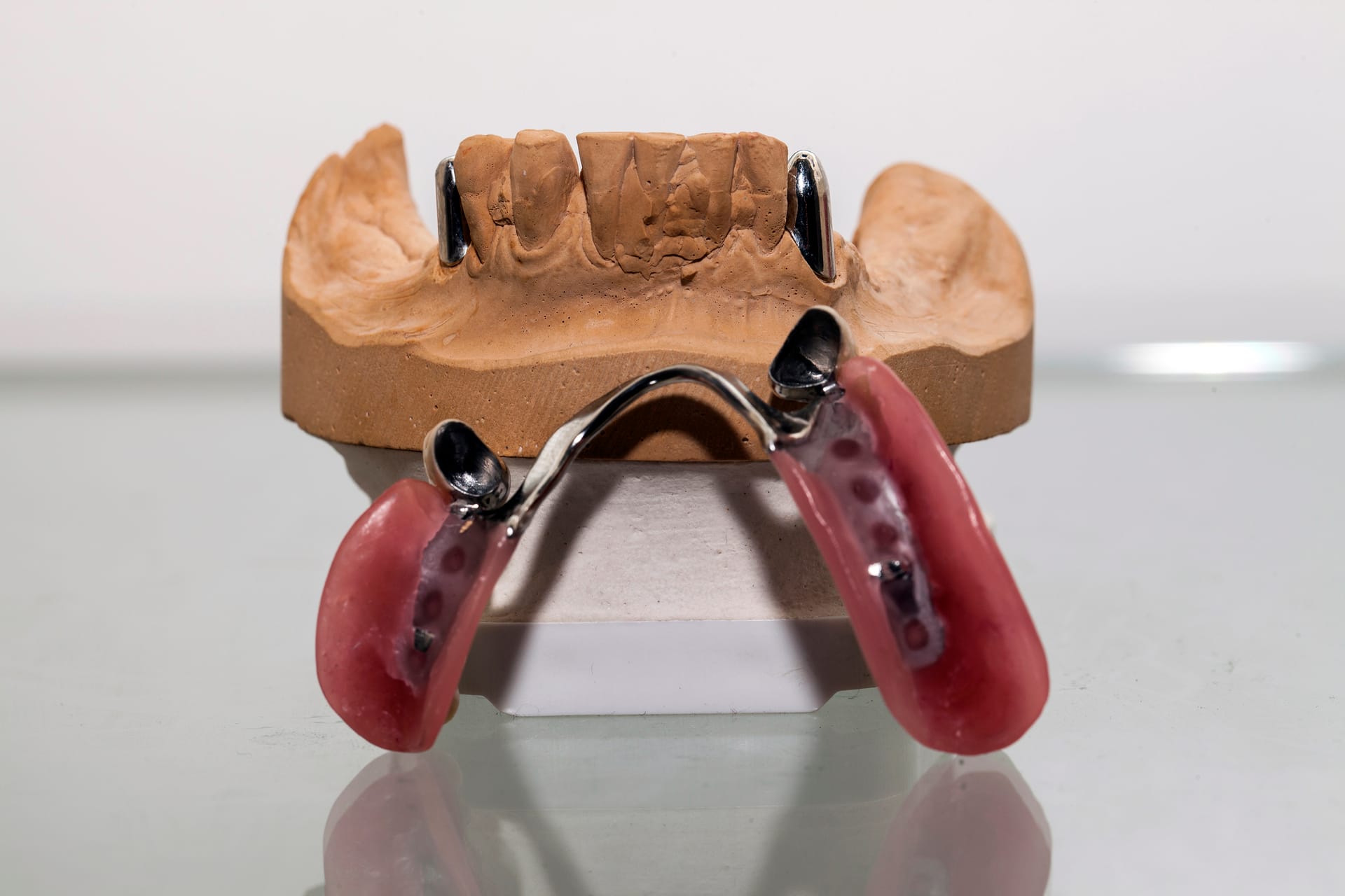 tudo sobre Prótese Parcial Removível: