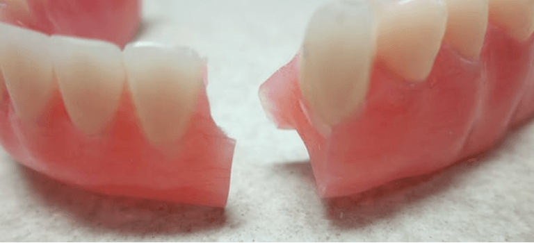 Conserto de Prótese Dentária na Hora: tudo que você precisa saber