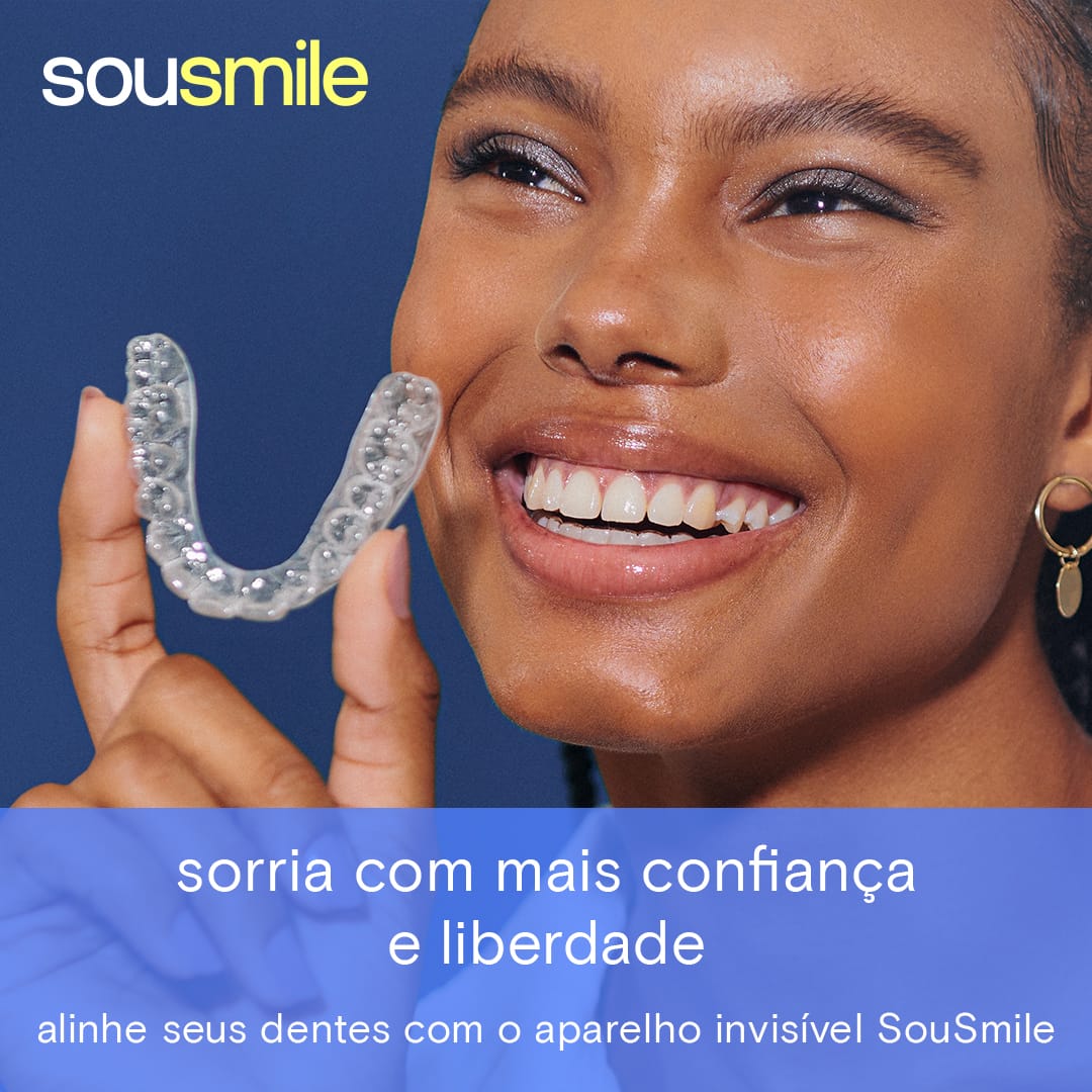 Alinhador Invisível Sousmile na Zona Leste: Por que Fazer Seu Tratamento na Odonto Gama?