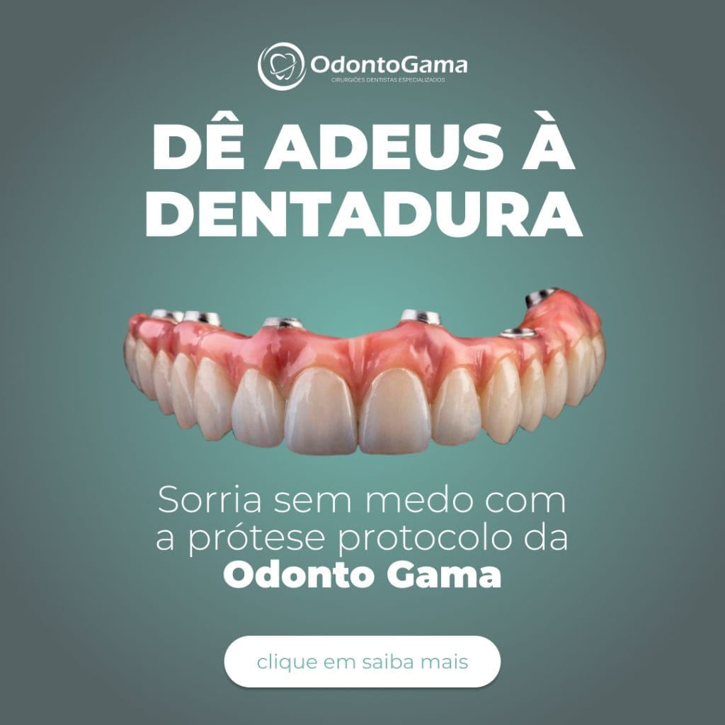 Prótese Protocolo: Guia Completo sobre a Solução que Devolve seu Sorriso