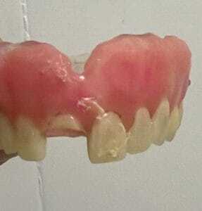 conserto de prótese odonto gama