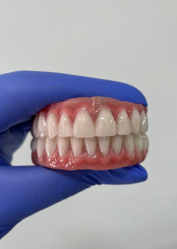 protese protocolo odonto gama