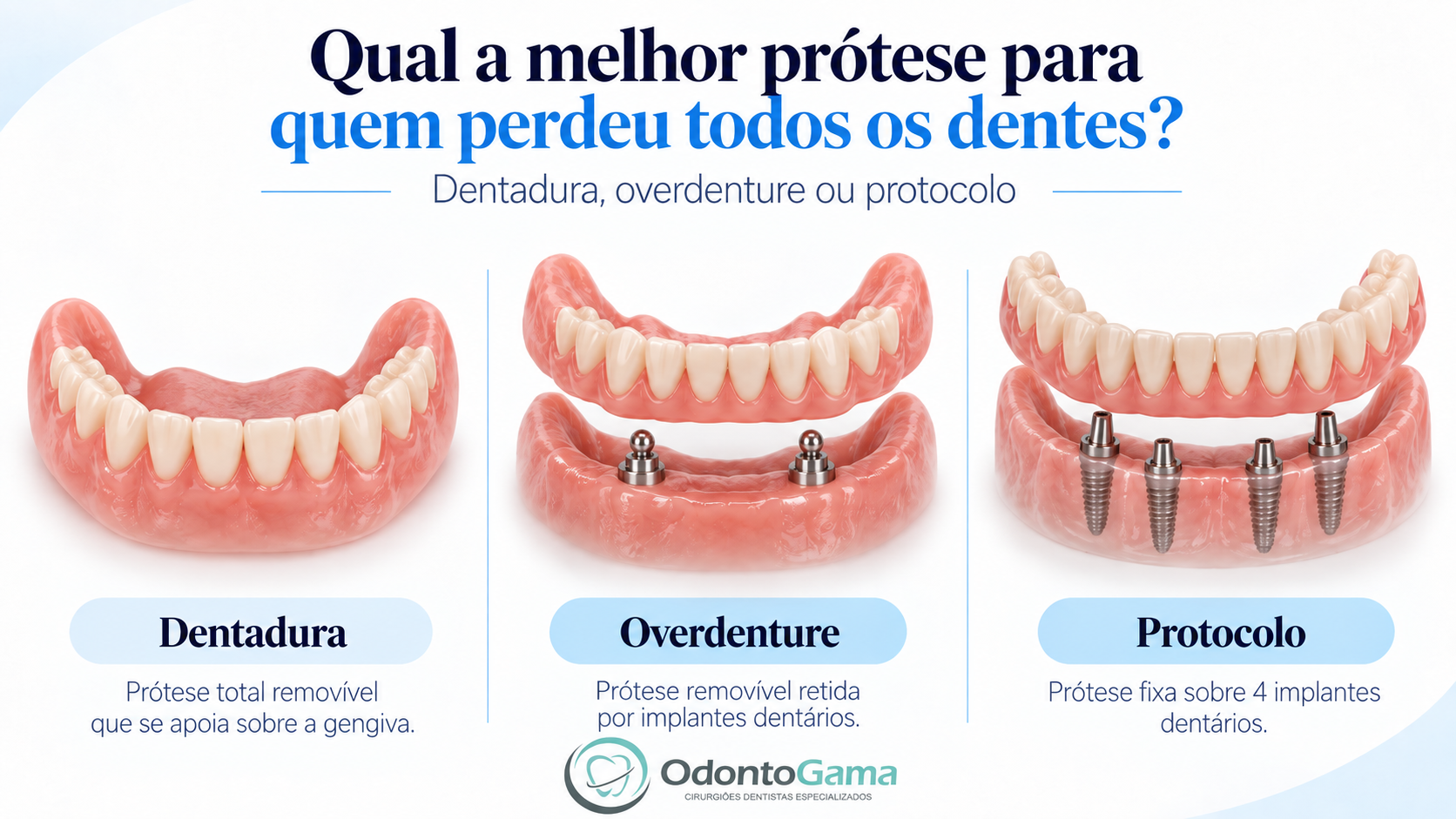 protese, protocolo e overdenture, odonto gama
