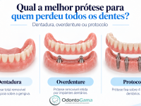 protese, protocolo e overdenture, odonto gama