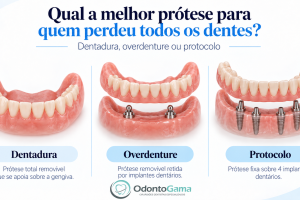 protese, protocolo e overdenture, odonto gama