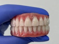 protese protocolo odonto gama