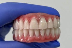 protese protocolo odonto gama