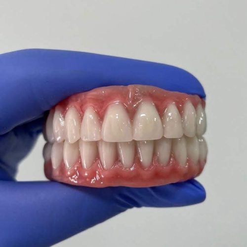 protese protocolo odonto gama